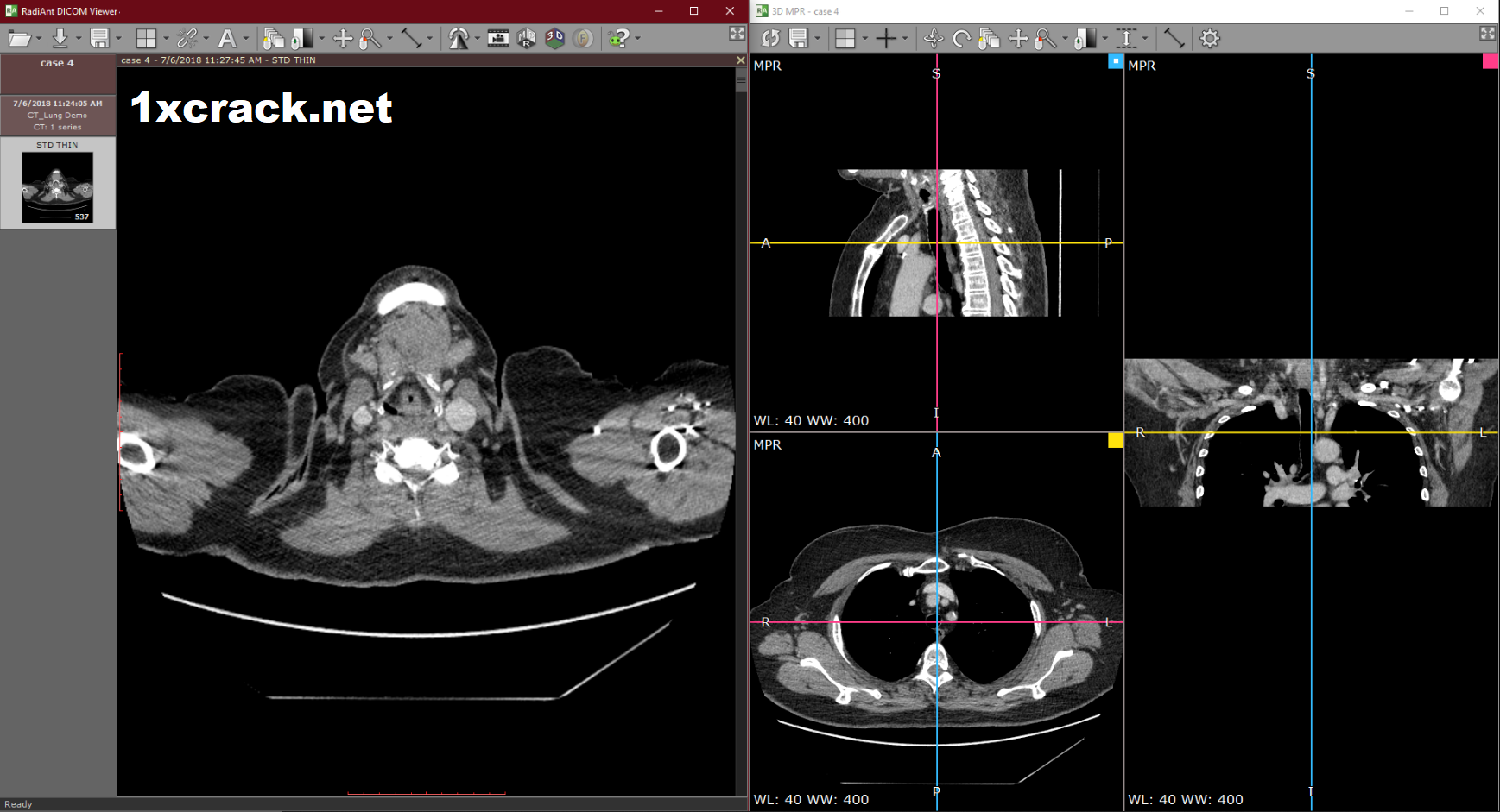 RadiAnt DICOM Viewer